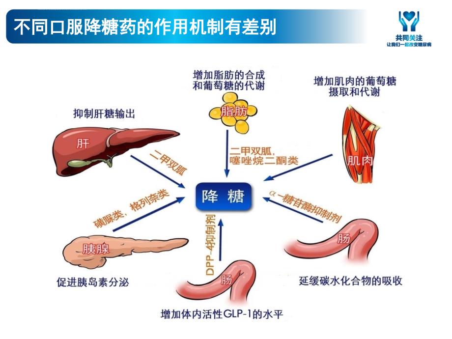 糖尿病教育之药物治疗.ppt_第4页