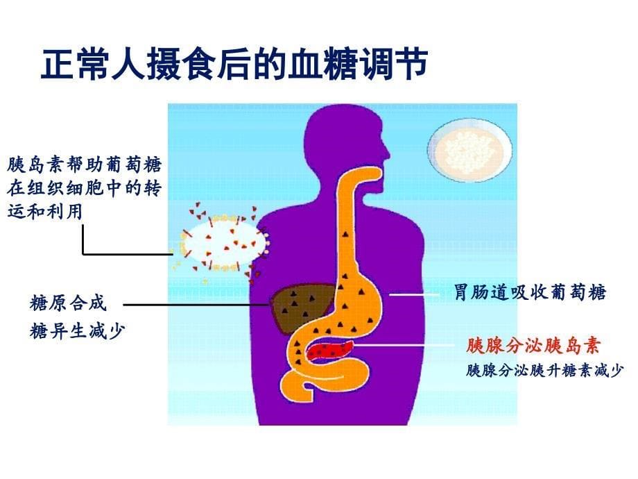 血糖波动的危害及控制.ppt_第5页