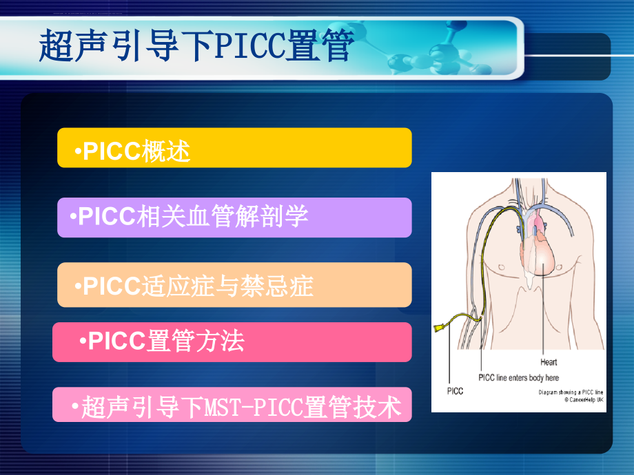 超声引导picc置管.ppt_第2页