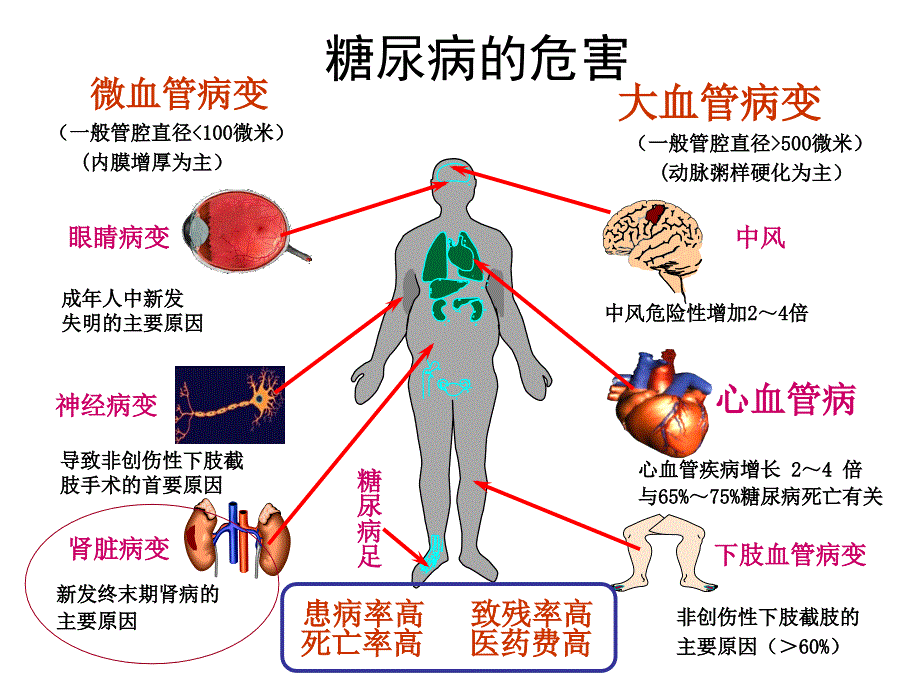 糖尿病肾病中医分期治疗.ppt_第3页
