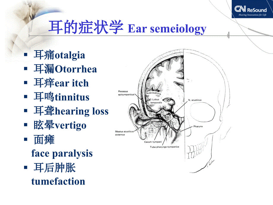 耳聋相关疾病与听力图分析.ppt_第2页