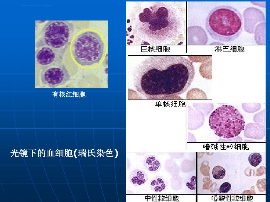 白细胞减少症.ppt_第2页