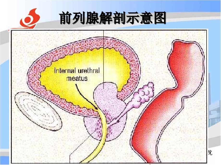 前列腺电切术后并发症的防治资料_第2页