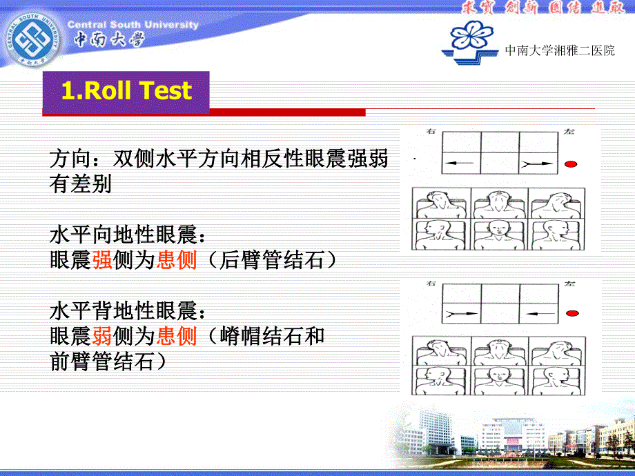 定侧困难的水平半规管BPPV复位资料_第3页