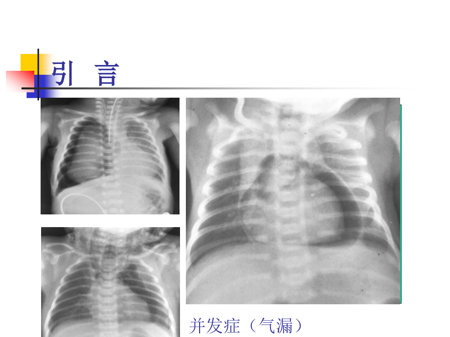 新生儿机械通气和安全氧疗资料_第3页