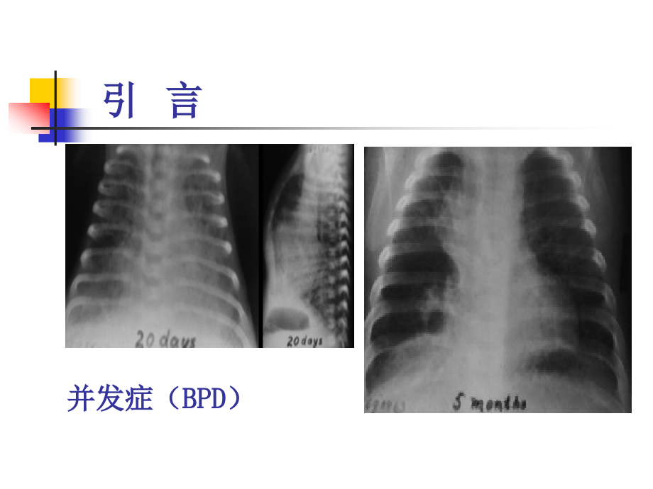 新生儿机械通气和安全氧疗资料_第4页