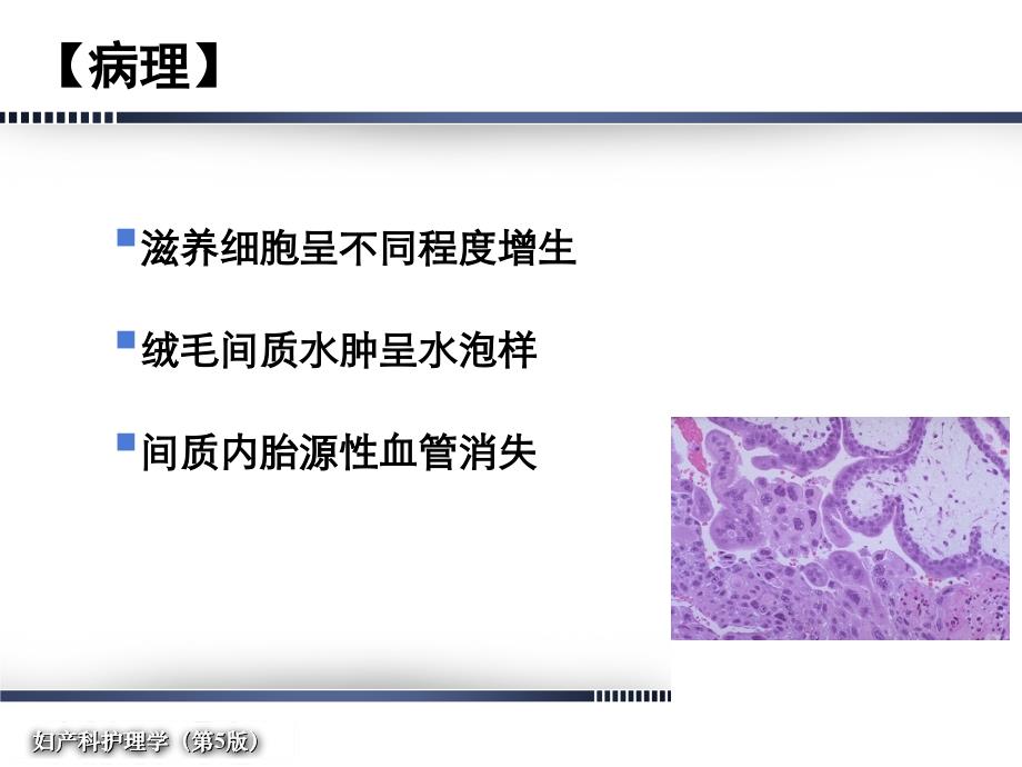 妇产科护理学-第章--妊娠滋养细胞疾病病人的护理_第3页