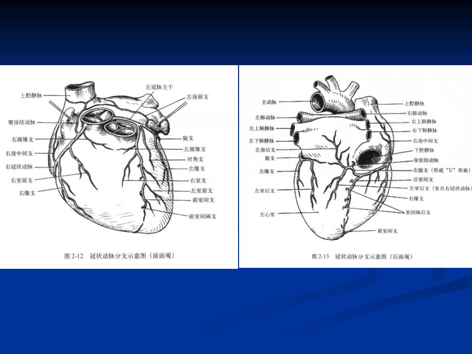 冠状动脉解剖与冠心病ct_第4页
