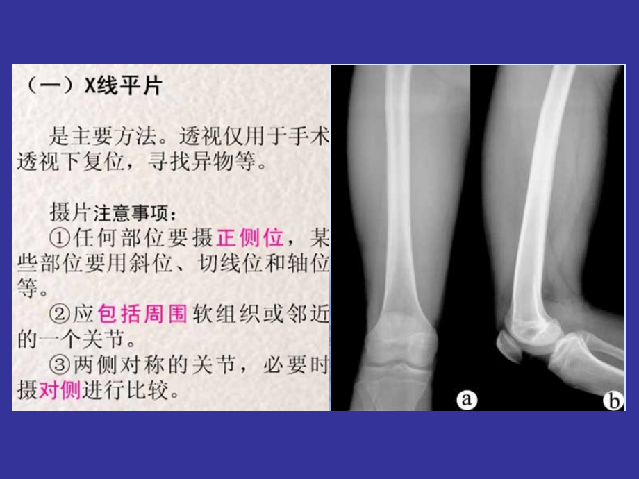 骨骼与肌肉系统资料_第3页