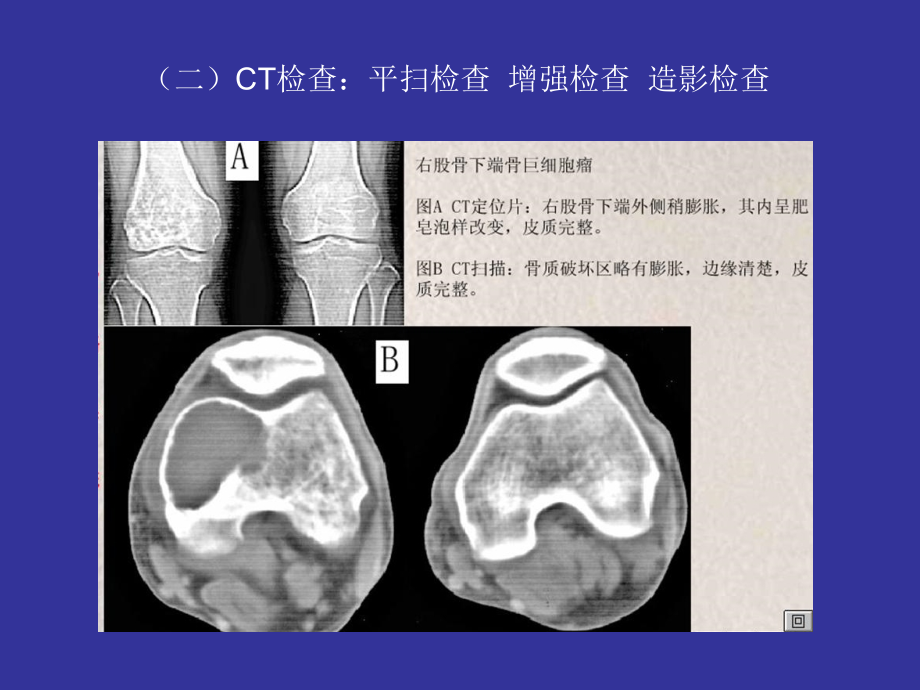 骨骼与肌肉系统资料_第4页