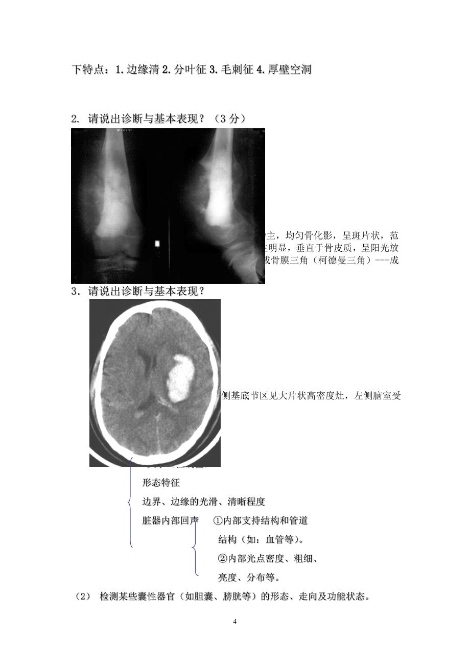 广州中医药大学临床医技课复习背诵终极版_第4页