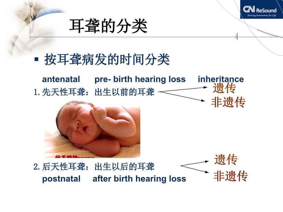 耳聋与听力图分析资料_第3页