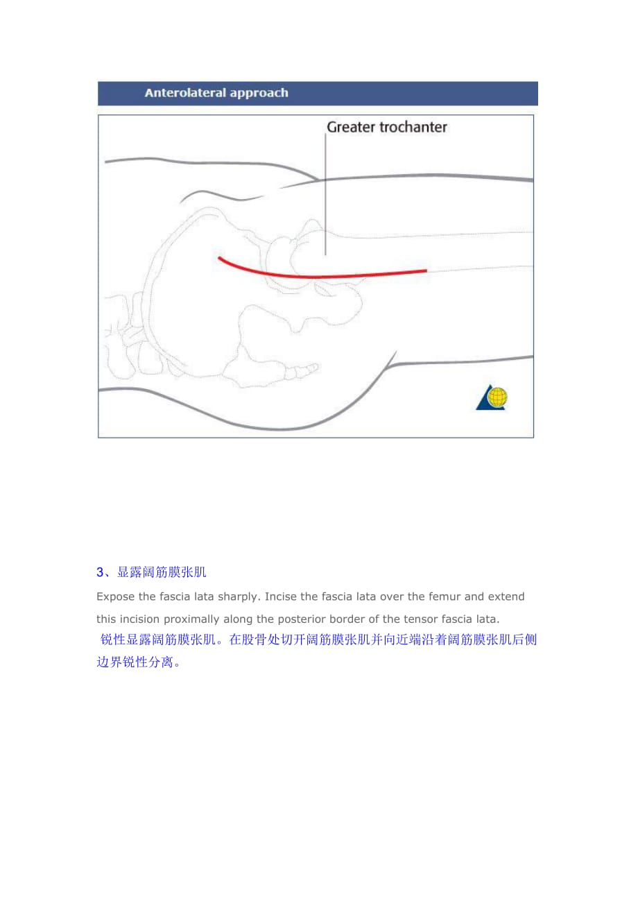 髋关节前外侧入路----Watson-Jones切口_第2页