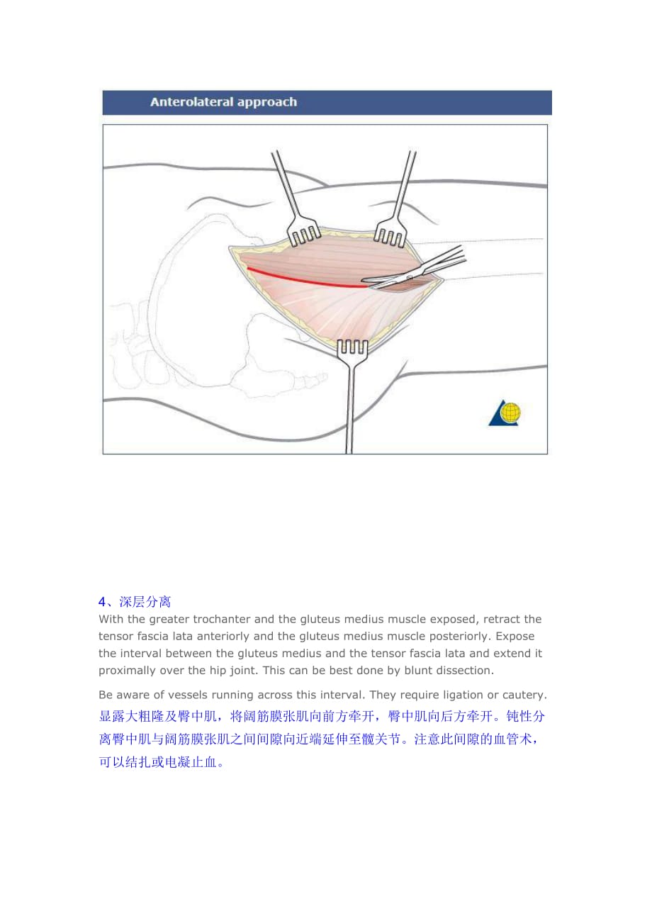 髋关节前外侧入路----Watson-Jones切口_第3页