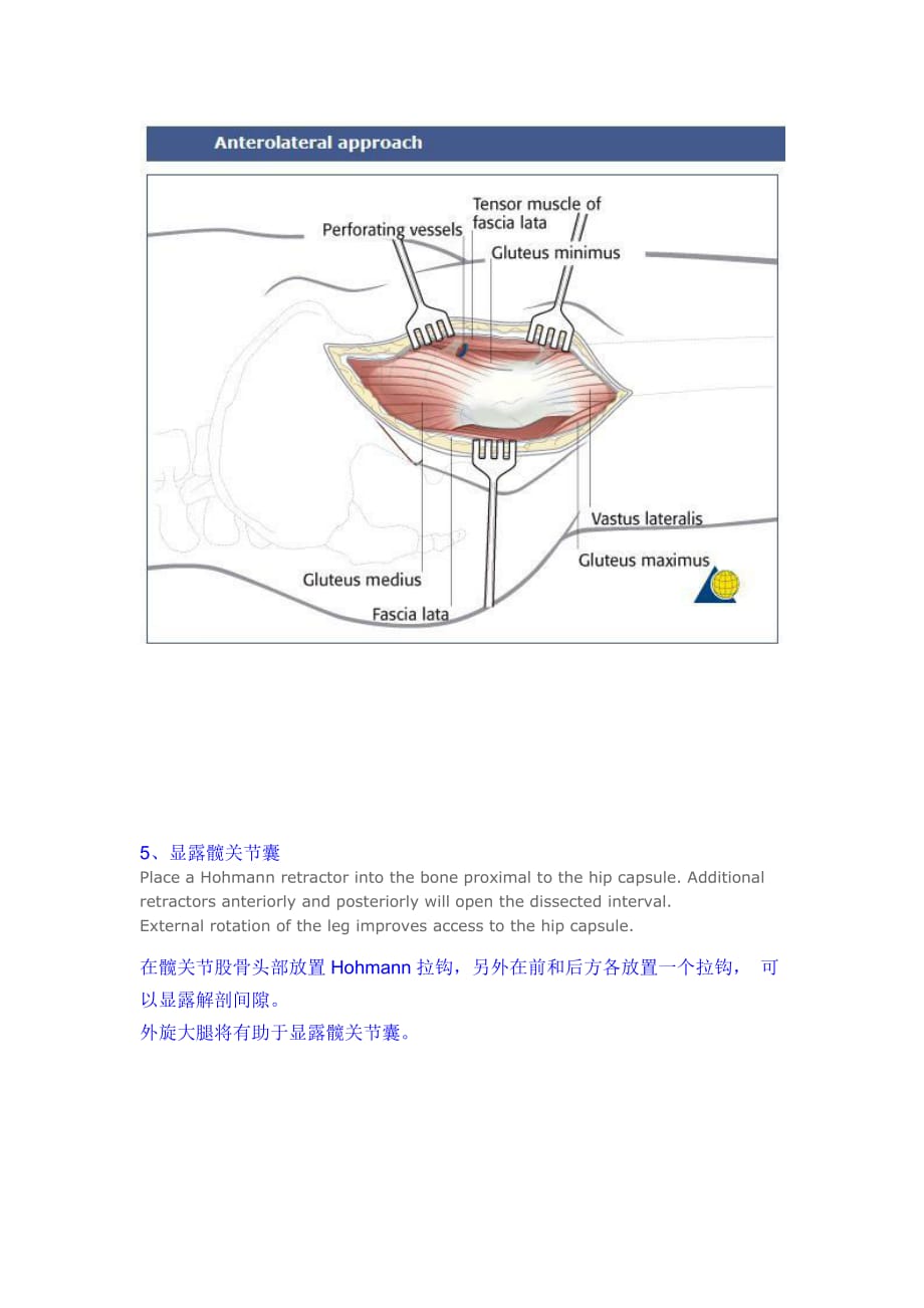 髋关节前外侧入路----Watson-Jones切口_第4页