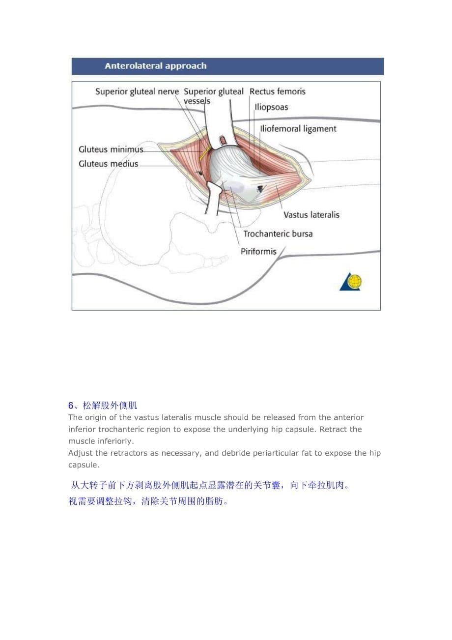 髋关节前外侧入路----Watson-Jones切口_第5页