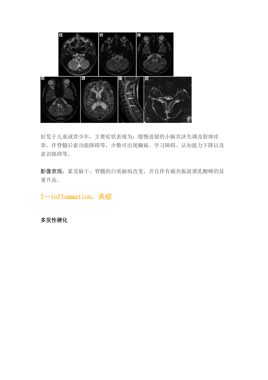 图理清脑干病变代谢炎症篇_第4页