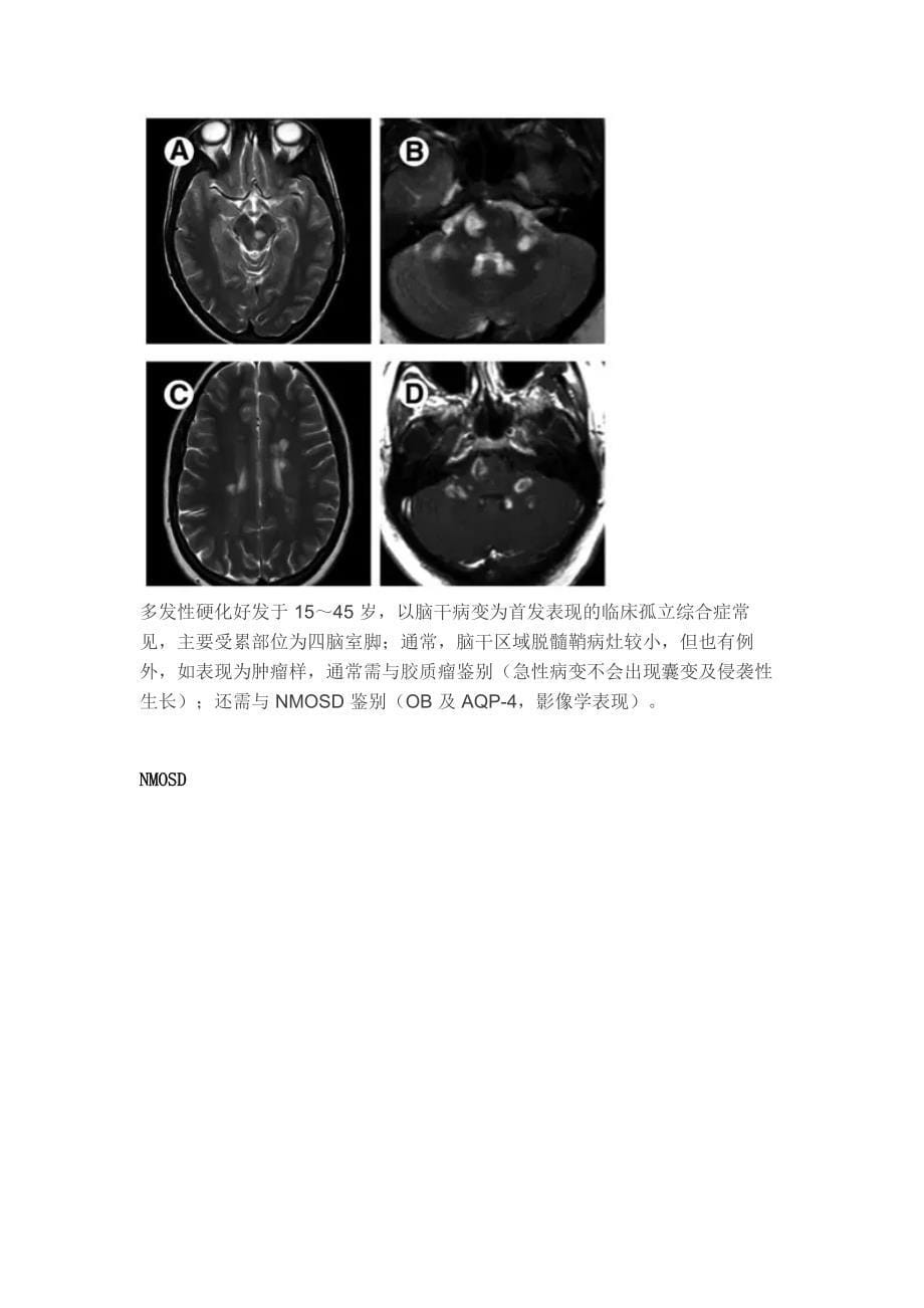 图理清脑干病变代谢炎症篇_第5页