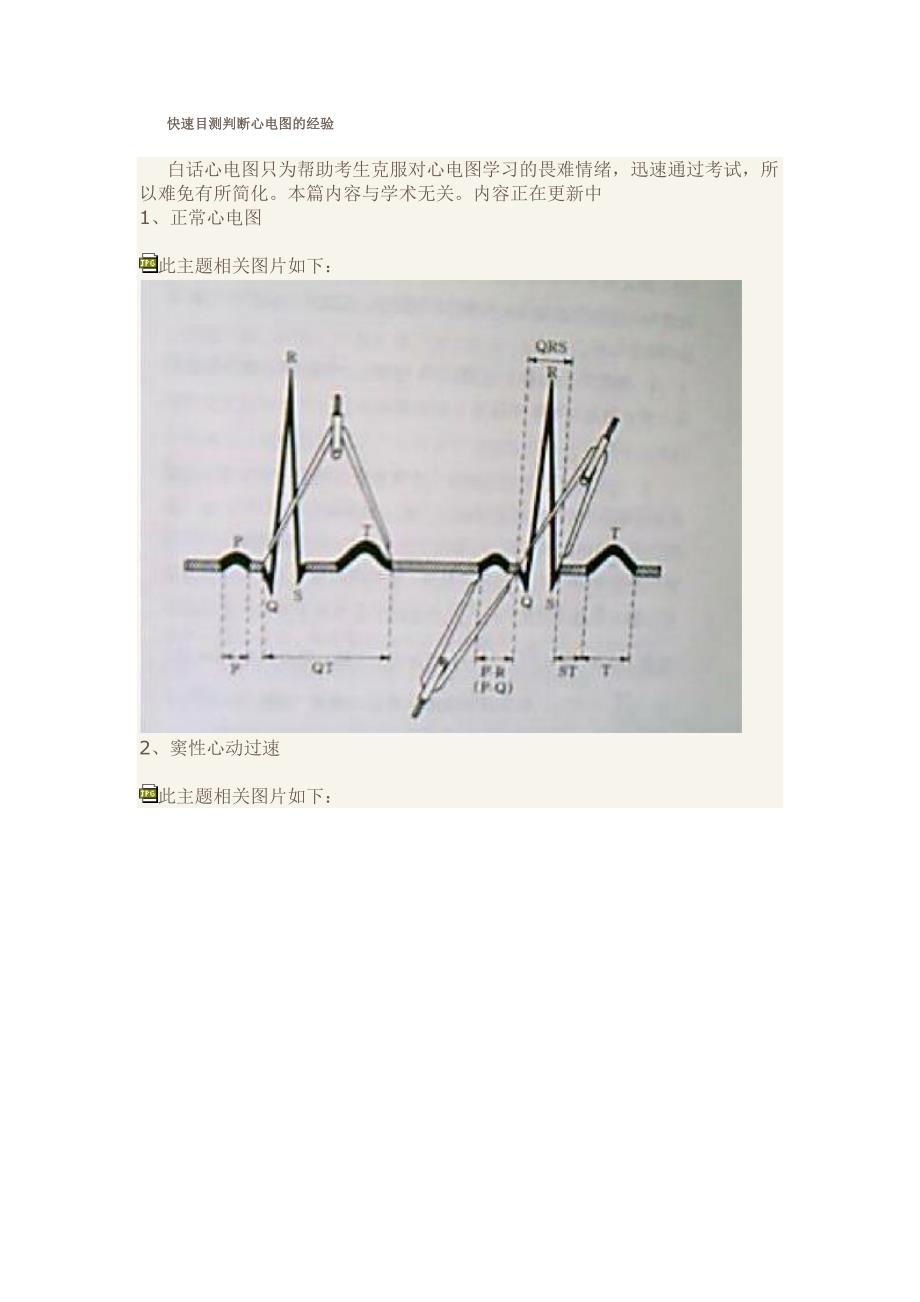 快速读懂心电图口诀速记_第3页
