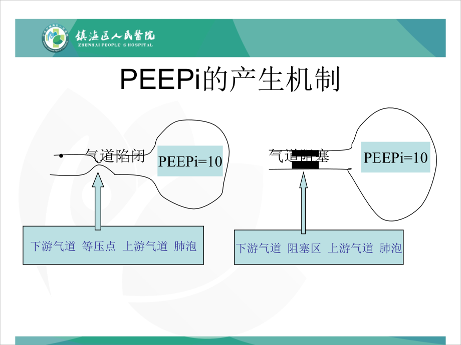 BiPAP呼吸机培训教材_第4页