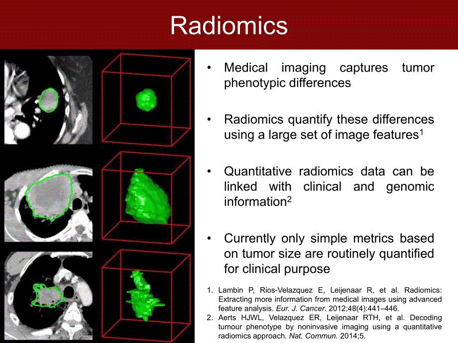 哈佛幻灯：CT影像组学预测非小细胞肺癌临床 结果_第2页