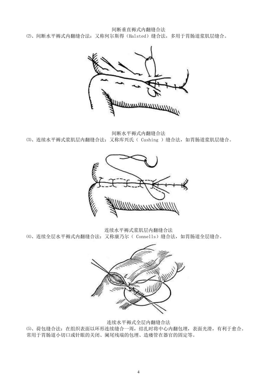 《外科手术缝合方法图解》2012版.doc_第4页