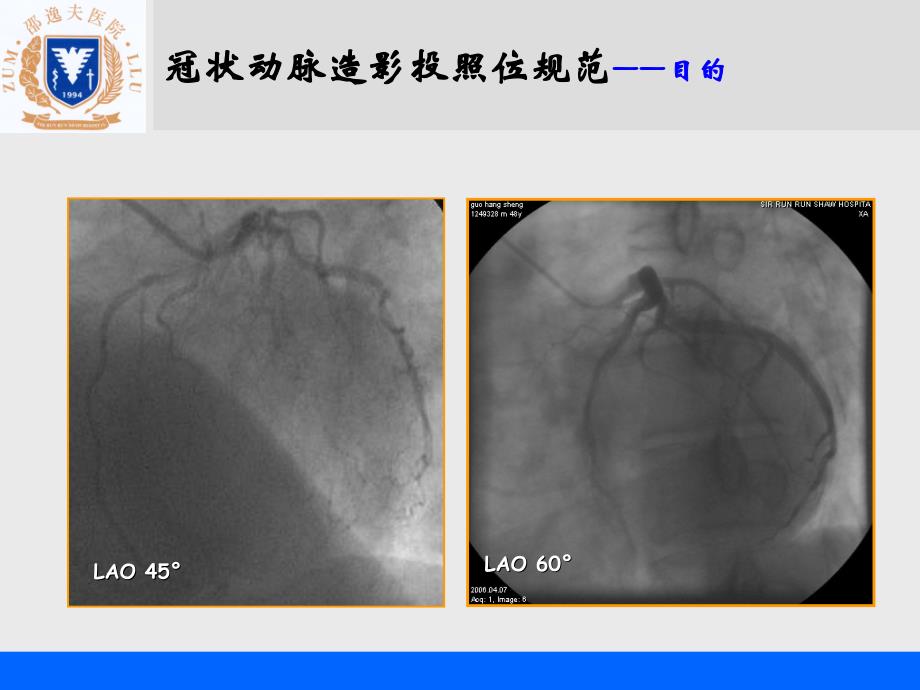 冠状动脉造影投照位规范与选择_第4页