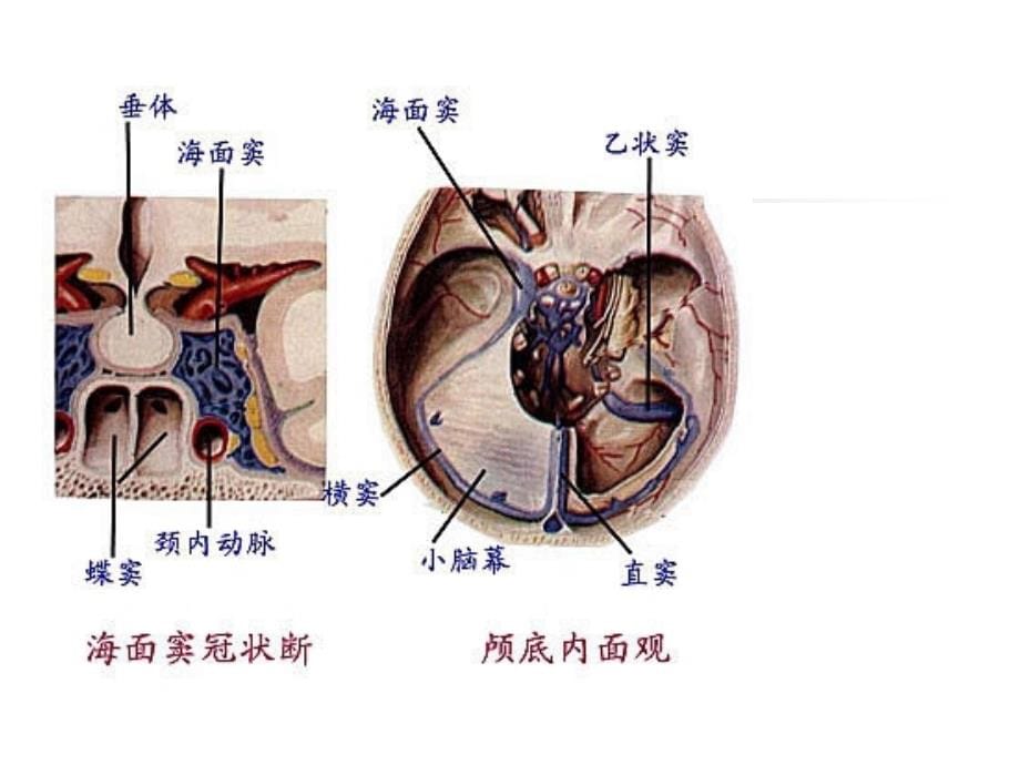 中枢神经系统影像诊断mri_第5页