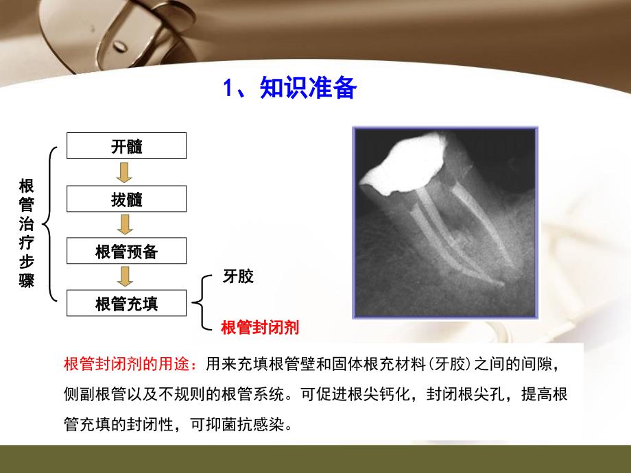 根充糊剂的调拌技术及注意事项_第3页