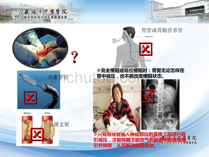 张主任临床科室肠梗阻导管使用护理讲座培训深圳._第5页