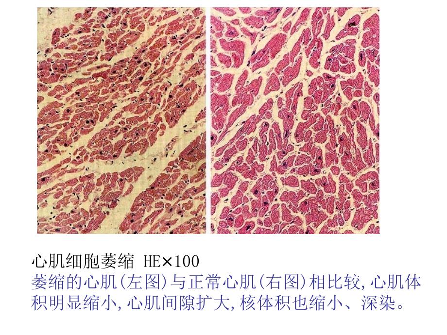 病理切片复习 演示文稿._第2页