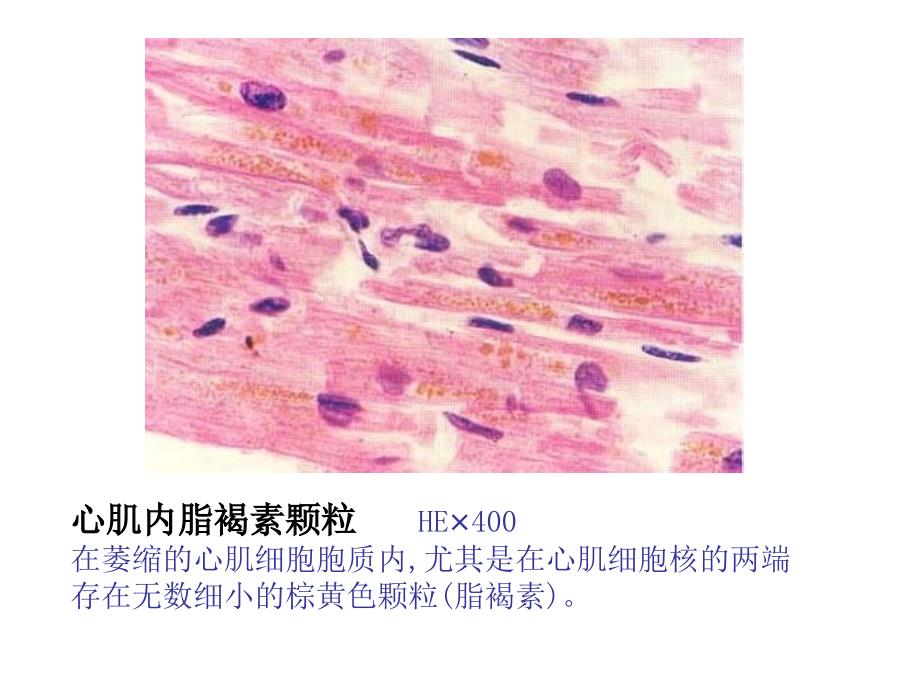 病理切片复习 演示文稿._第3页