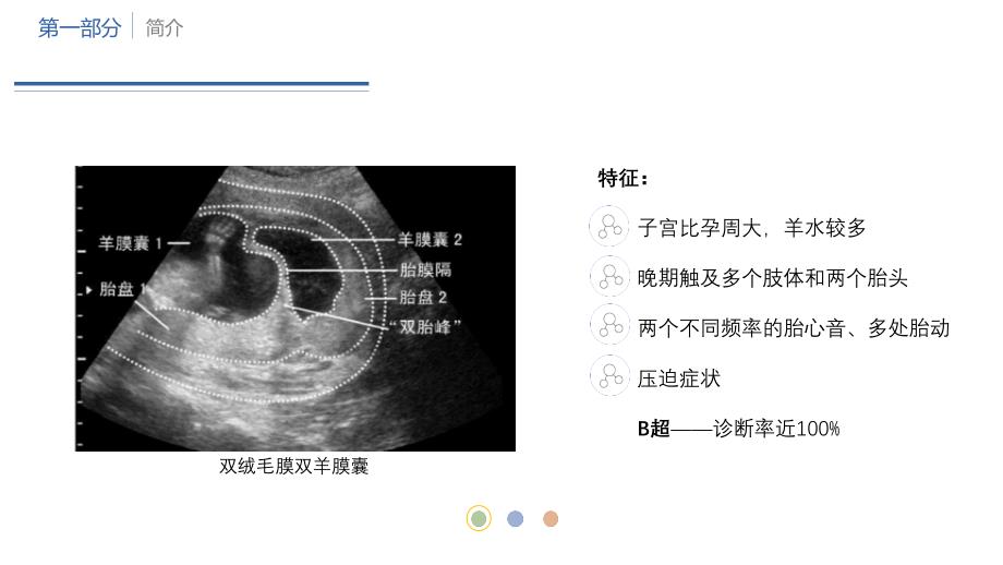 双胎妊娠---副本_第4页