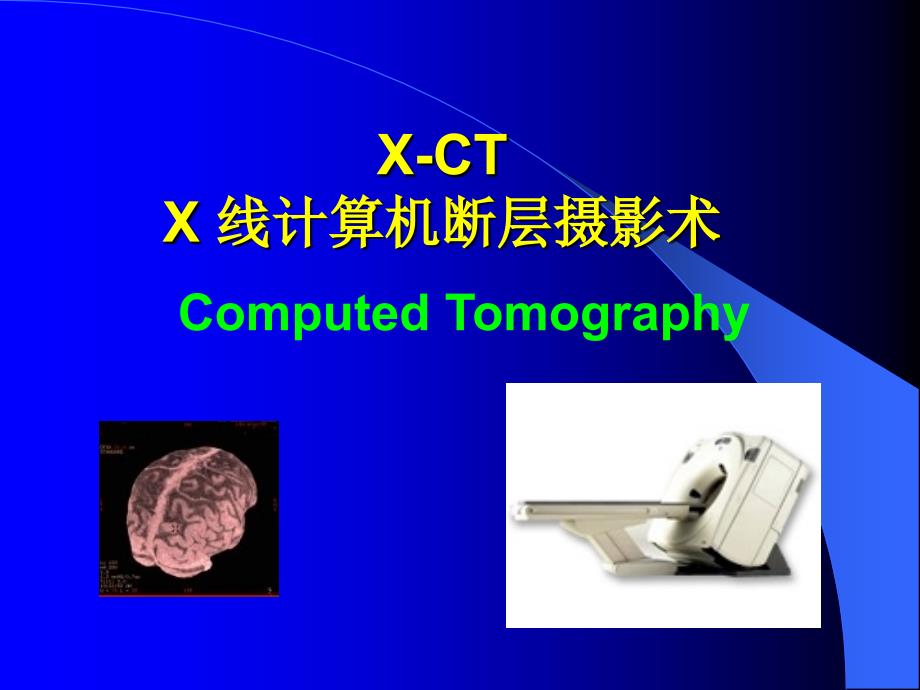 CT成像原理._第1页