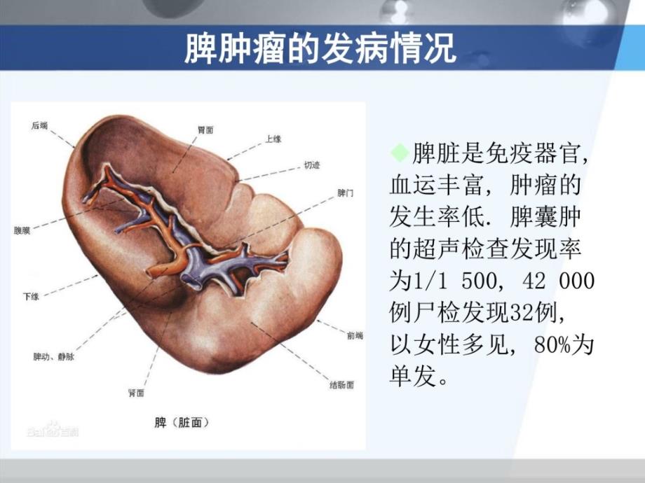 脾占位脾肿瘤介绍CT诊断_第4页