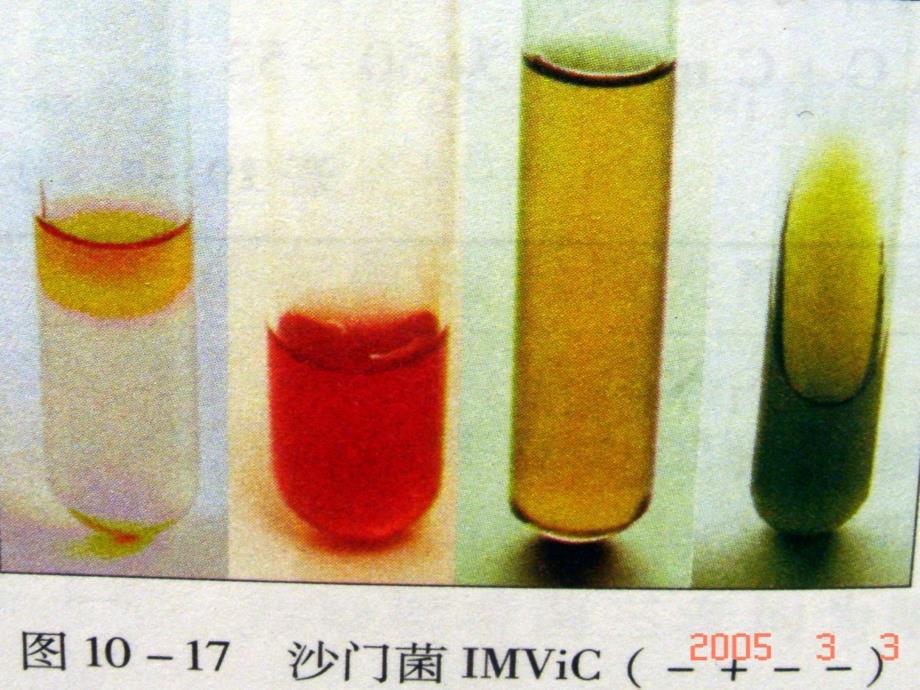 微生物学志贺菌门菌耶尔森菌属_第3页