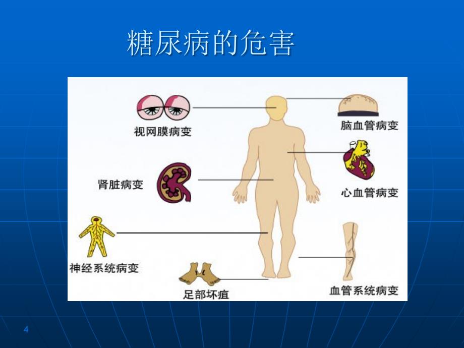 慢性疾病培训课件知识讲座._第4页