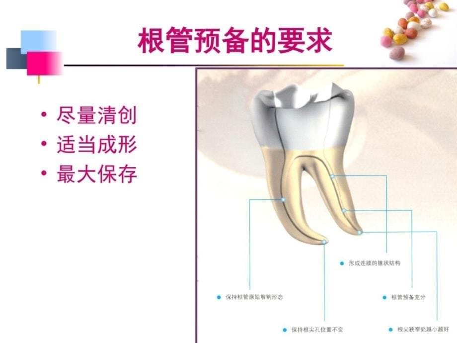 热牙胶充填技术PPT_第5页