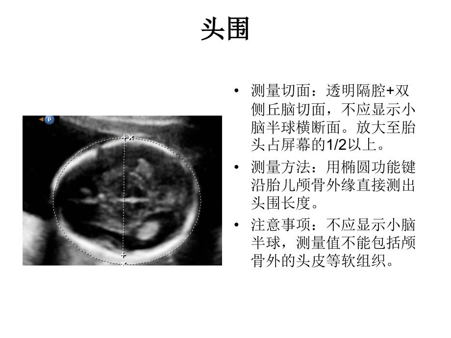 产科超声标准切面25张图._第2页