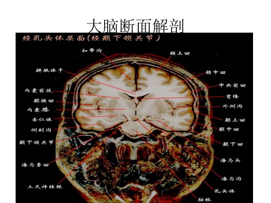 大脑结构图图例精选资料_第2页