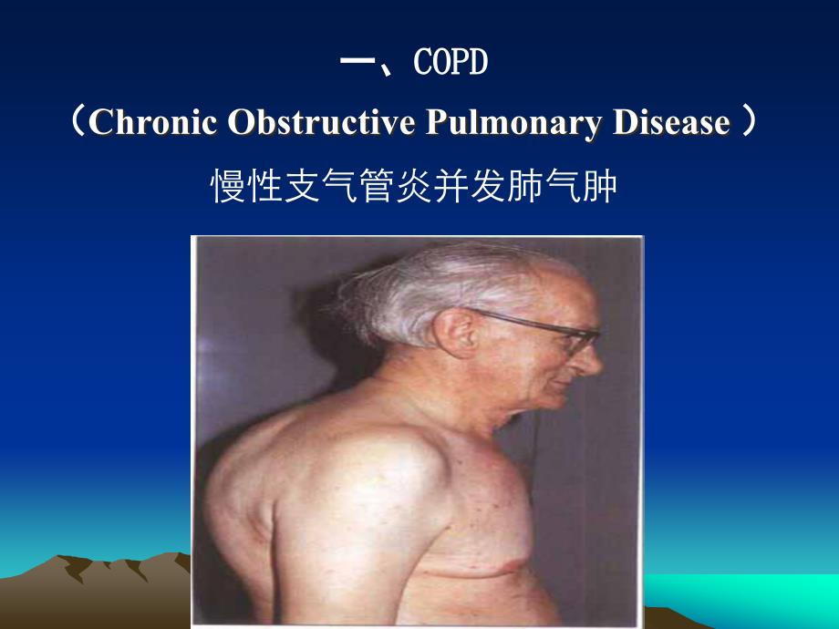 呼吸系统常见疾病的主要症状和体征资料_第3页