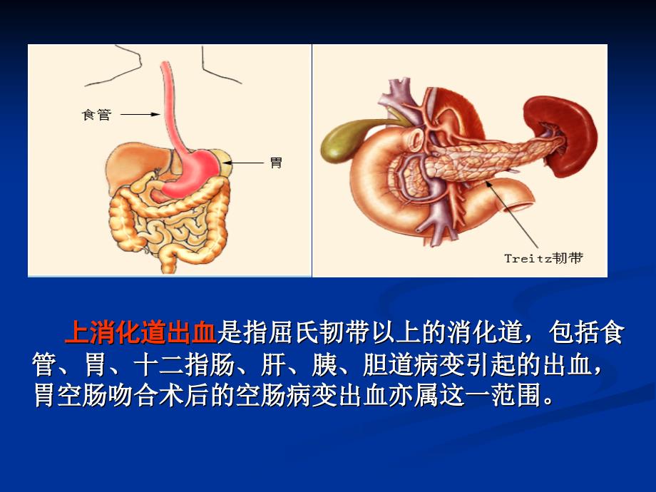 消化道出血护理查房(带病例)._第3页