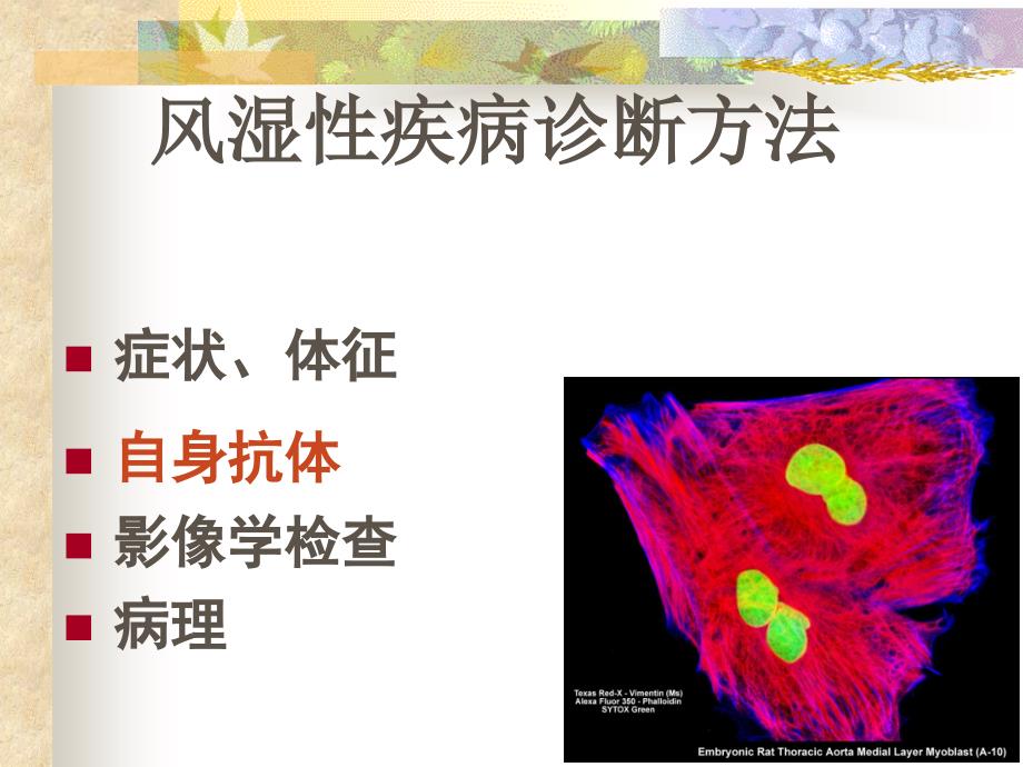 风湿性疾病中自身抗体的意义讲解_第2页