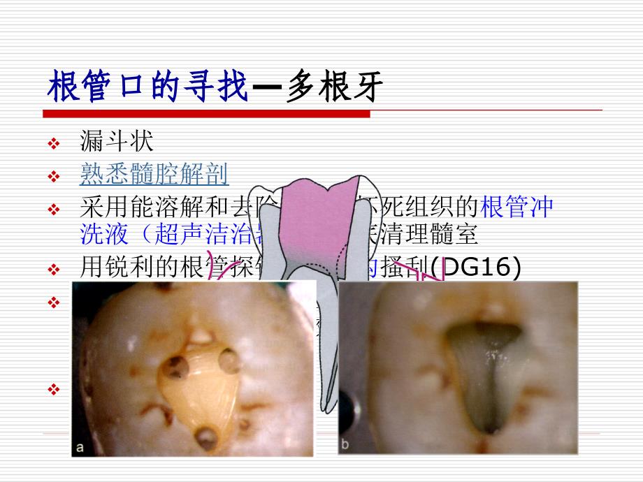 根 管 预 备_第2页