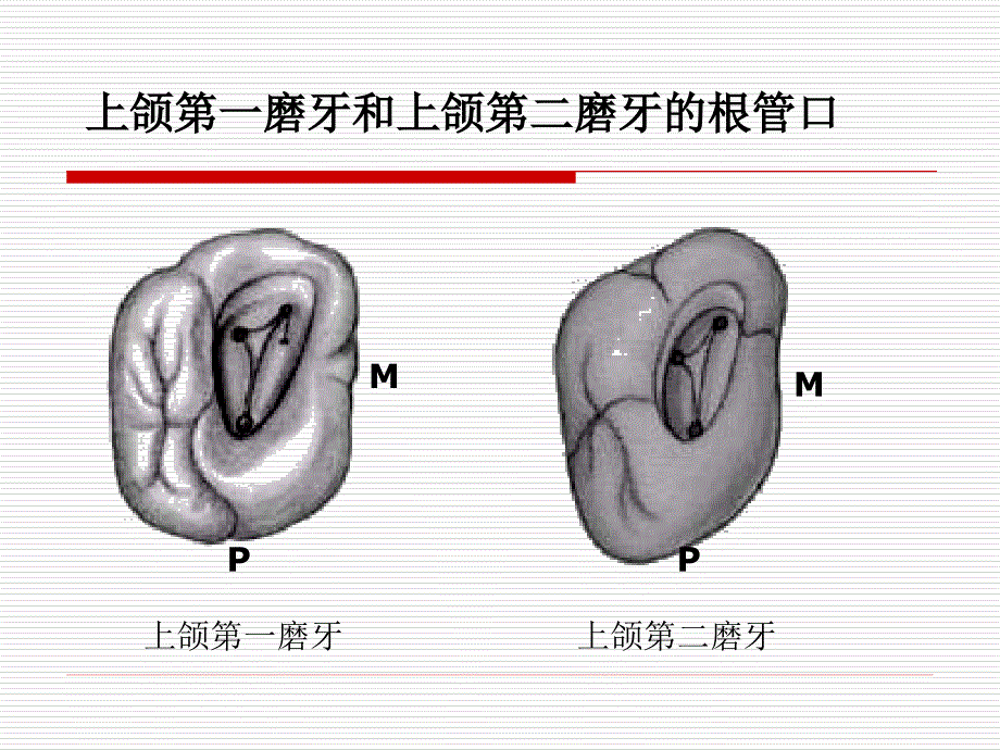 根 管 预 备_第4页