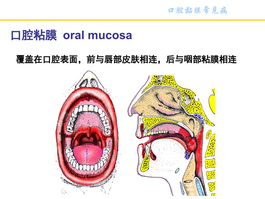 口腔粘膜病._第3页