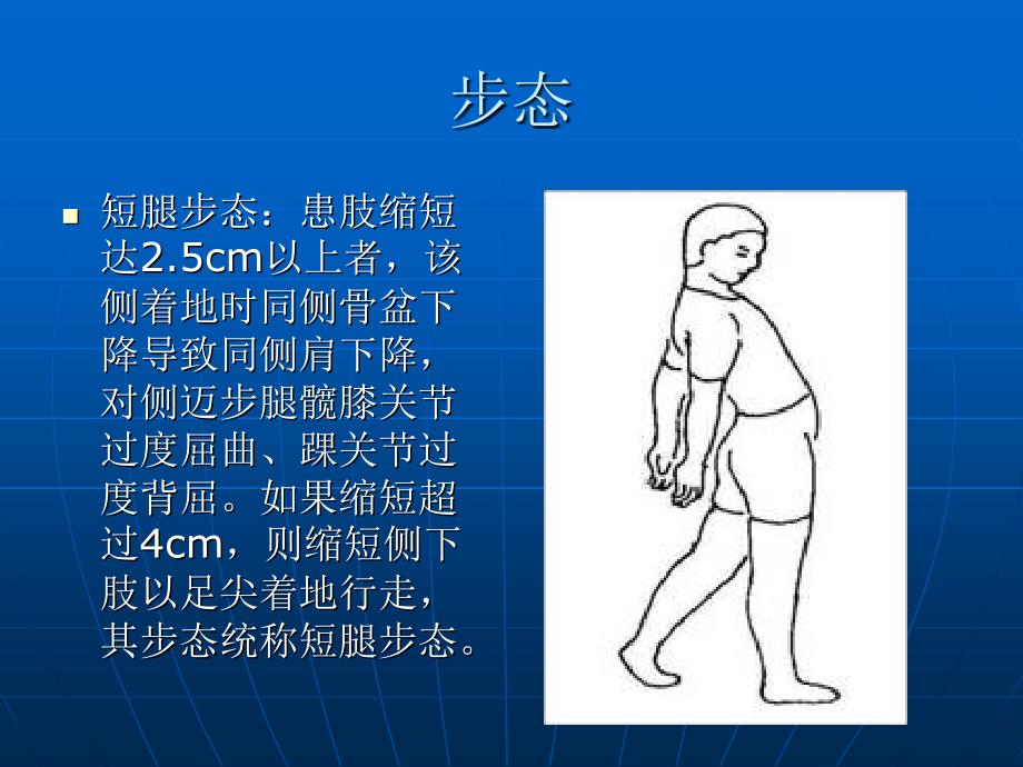 髋关节体格检查详解_第4页