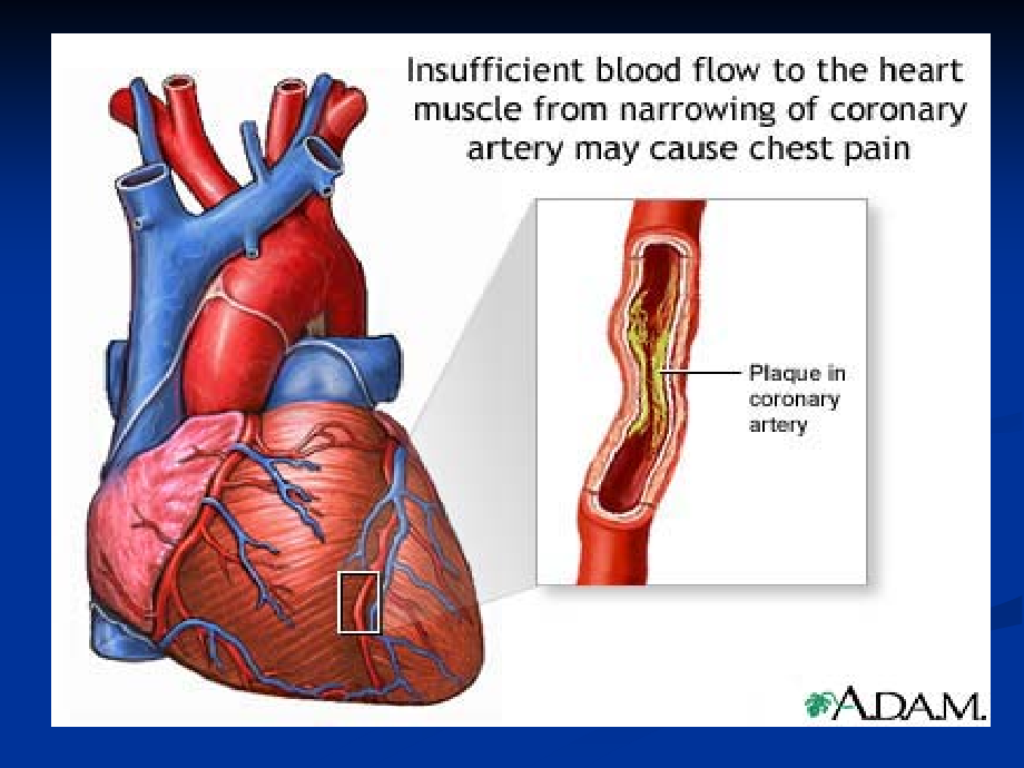 心血管系统疾病 (3)_第4页