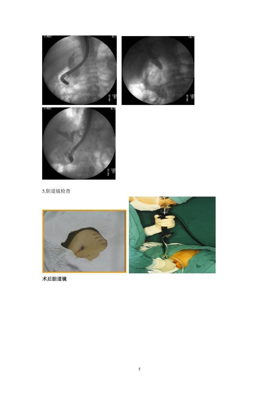 第十三节胆道疾病_第5页