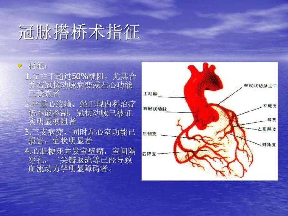 冠脉搭桥桥血管的选择._第4页